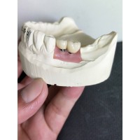 CE/FDA認證種植牙代工廠（滿足國際醫療器械出口要求